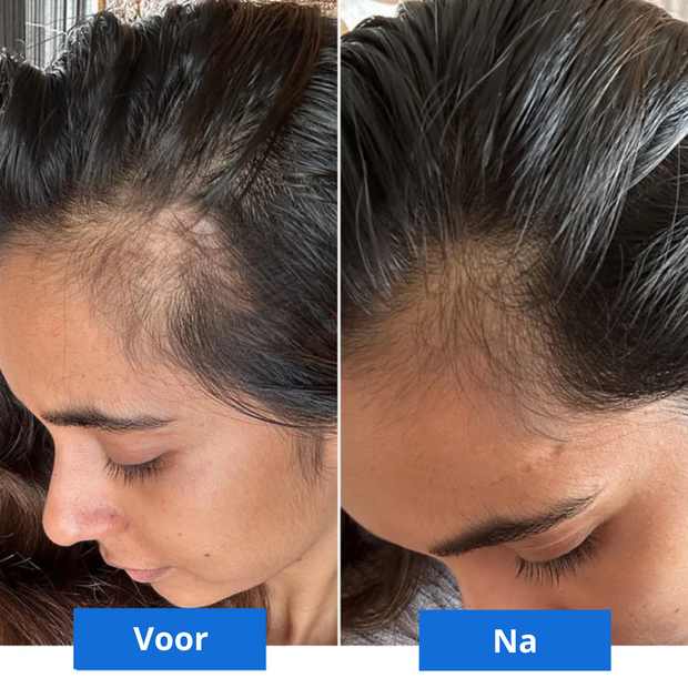 ZenLuxe™ | Pure Sereniteit