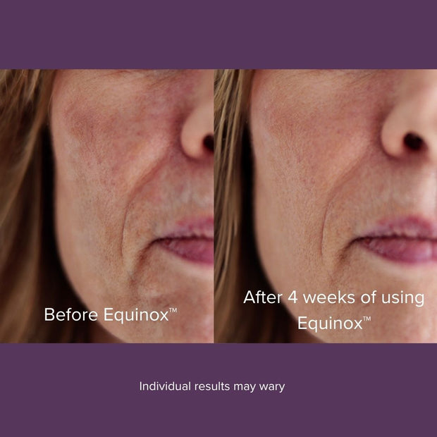 Eclipta | LED Contour Mask