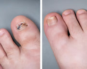 GlowNail™ | Verjong je nagels in 14 dagen - Voor stralende tenen en vingers!